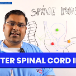 Sex After Spinal Cord Injury Penile Implant Spinal Cord Injury