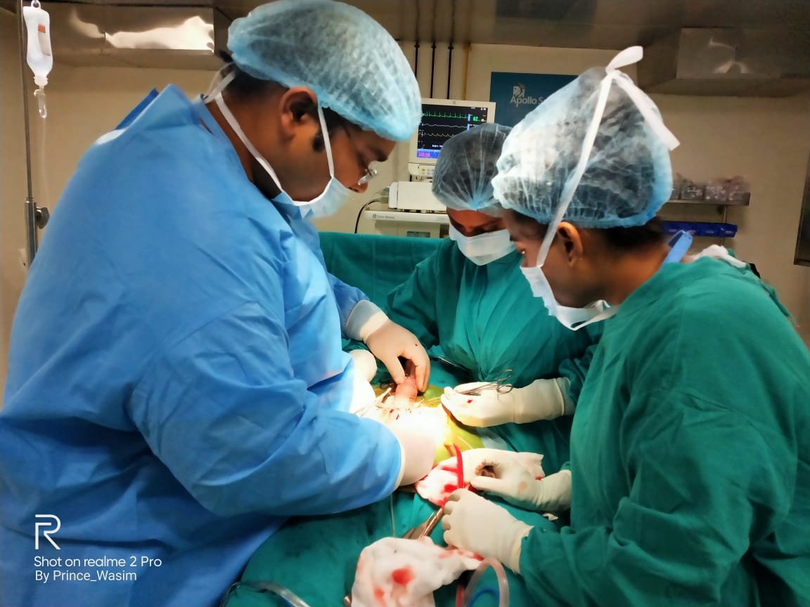 Dr Vijayant govinda Gupta doing cavernotomy with a cavernotome (penile fibrosis and penile implantation)
