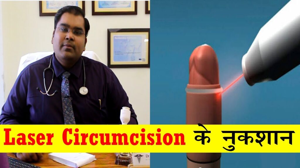 Complications of Laser Circumcision | Avoid Laser Circumcision in New Delhi India