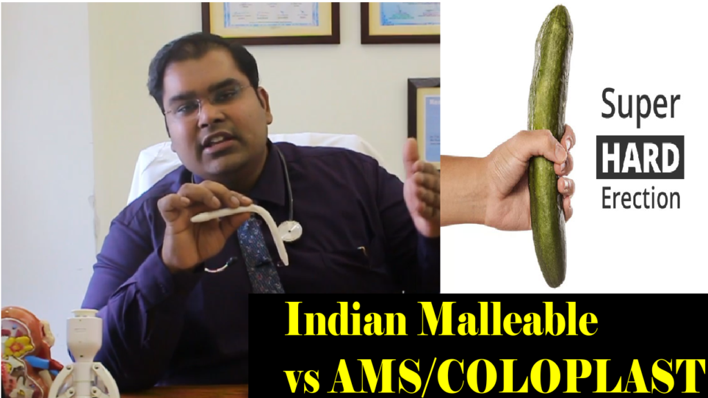 Indian malleable penile implant | Cheapest penile prosthesis in the world | Shah prosthesis new delhi india