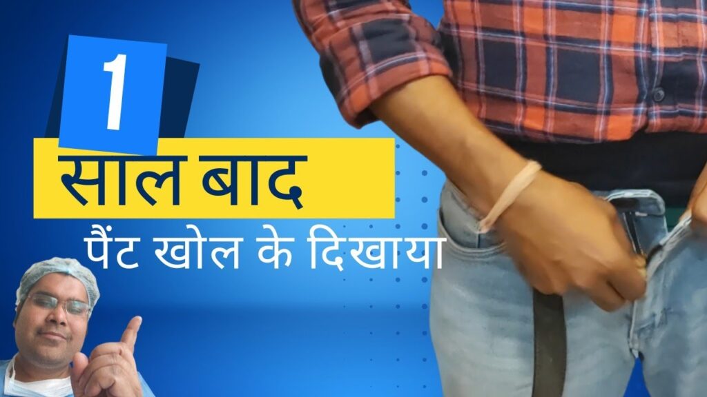 How to hide Indian Penile Implant in Clothes