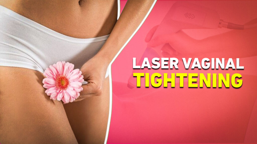 Laser Vaginal Tightening Treatment in Delhi