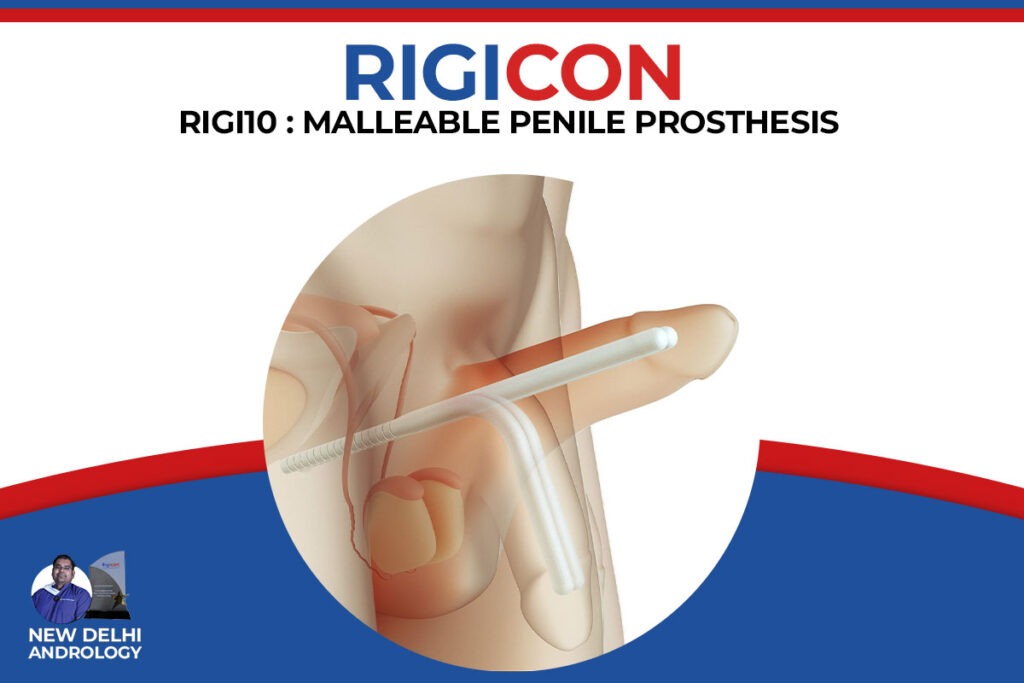 RIGI 10 malleable penile implant