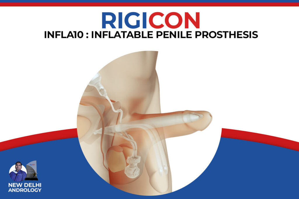 INFLA 10 Inflatable Penile Implant in India