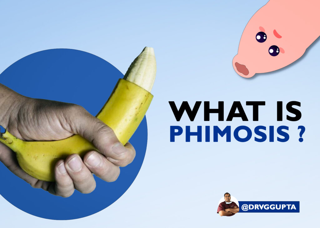 What Is Phimosis