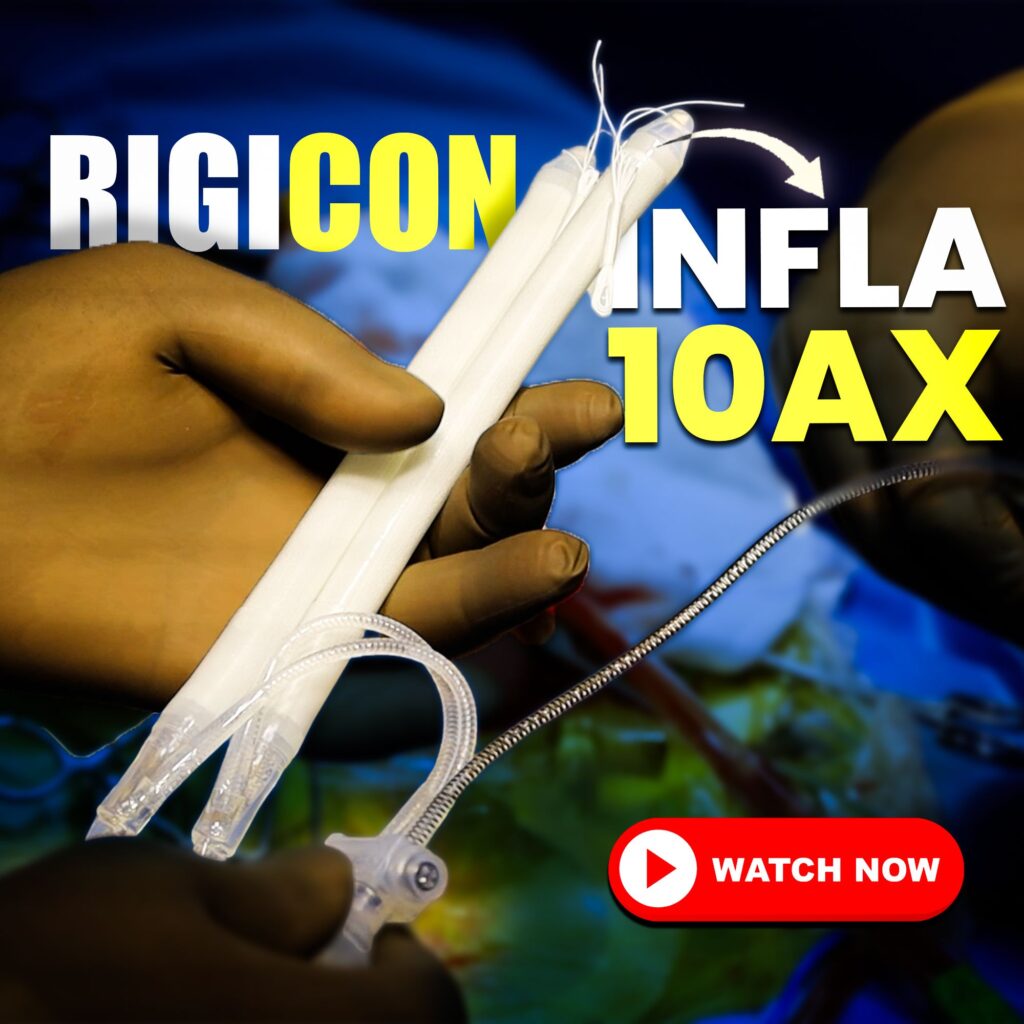 Dr. Vijayant Govinda Gupta holding a Rigicon Infla 10 Pulse penile implant