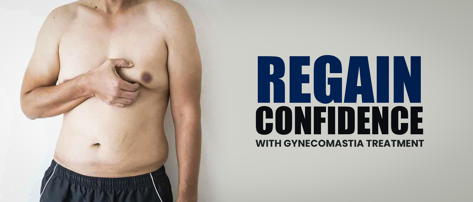 Gynecomastia Surgery In Delhi