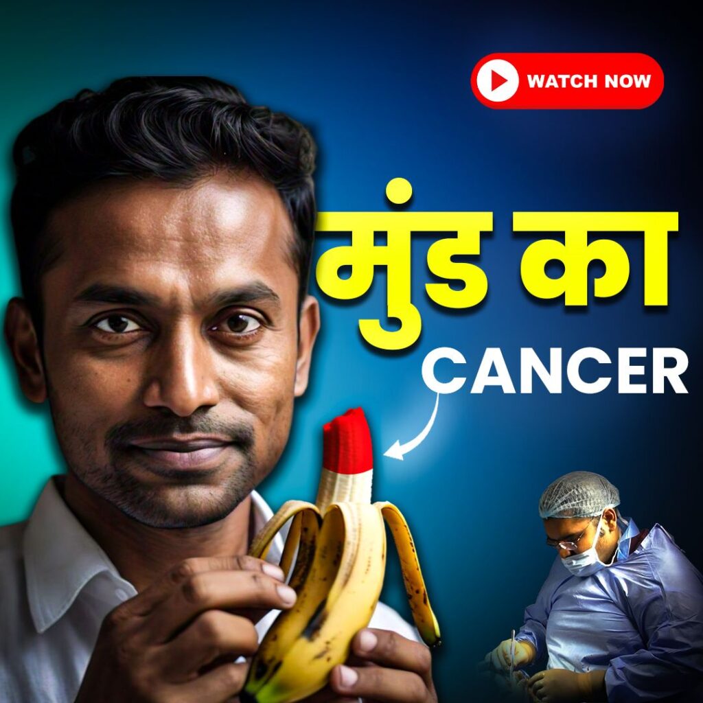 Penis Preserving Surgery: A Lifesaving Option for Penile Cancer (पेनिस को बचाने वाली सर्जरी: पेनिस कैंसर के लिए एक जीवनरक्षक विकल्प)