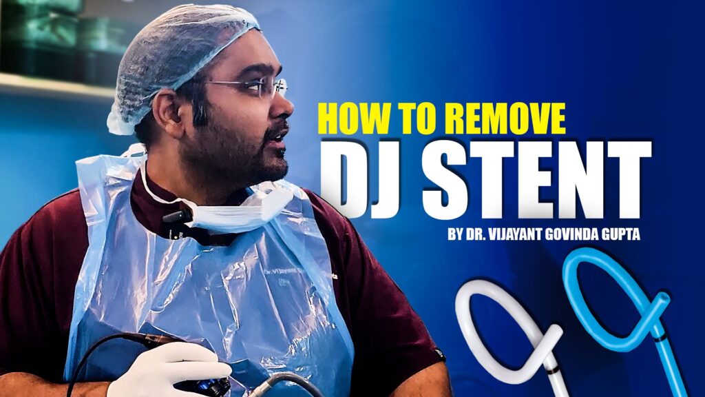 Dj stent remove delhi india