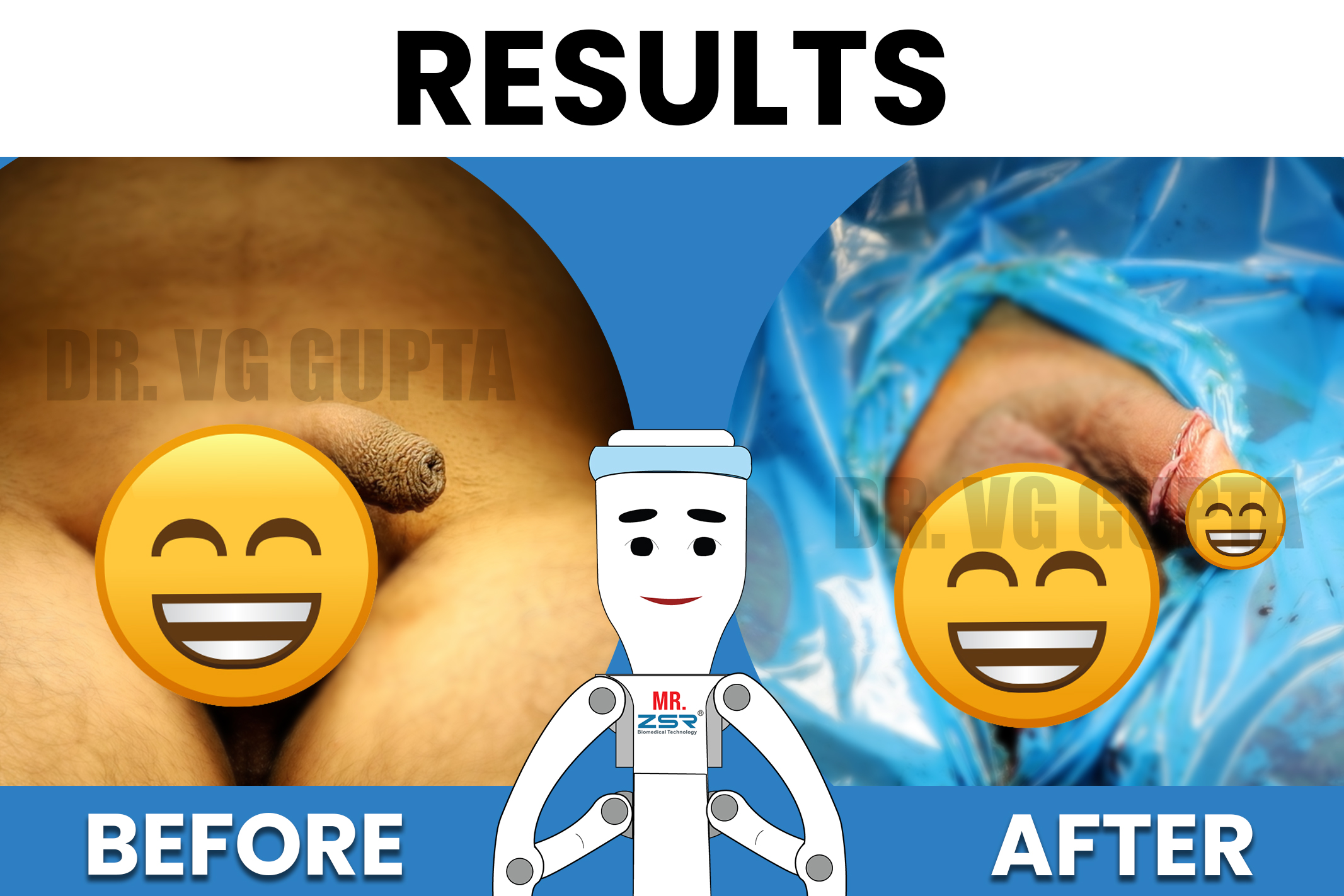 BEFORE-AFTER-results-zsr-6