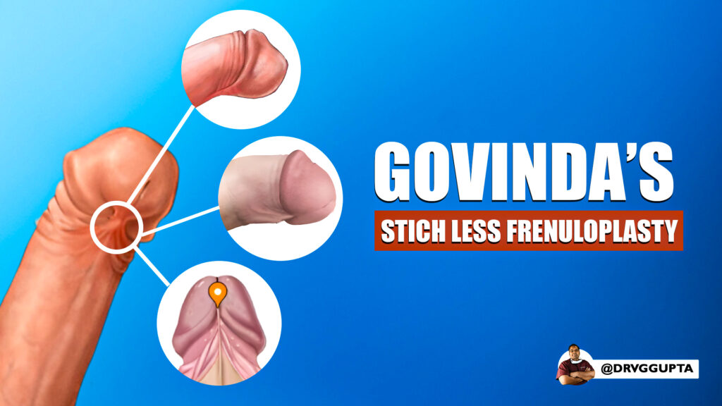 Govinda's Stitchless Frenuloplasty (Treatment of Tight Frenulum)